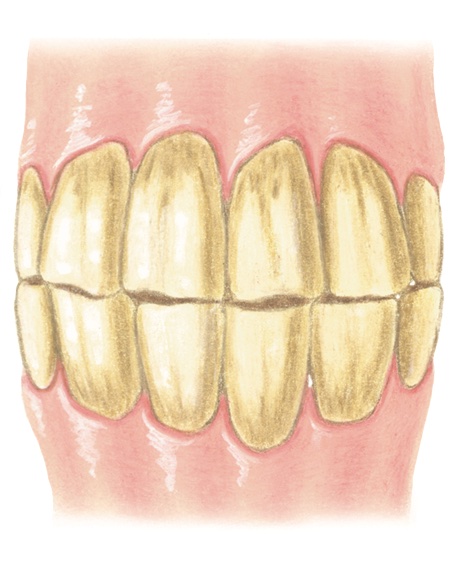 10-year-old horse's teeth anterior view