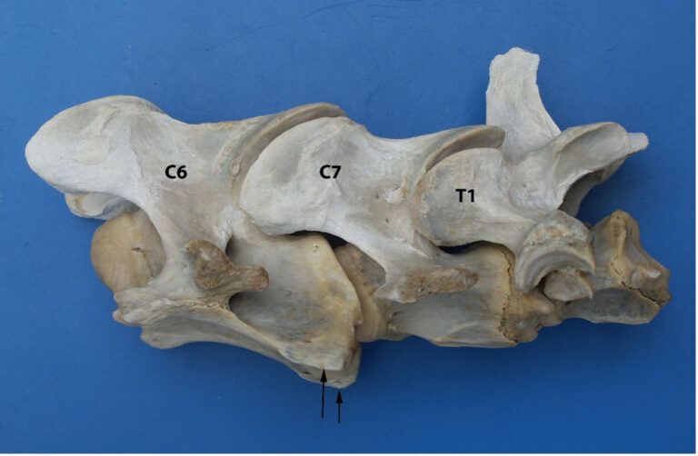 horse vertebrae