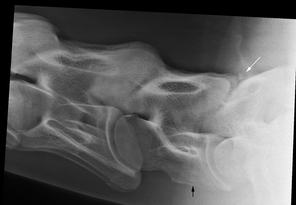vertebrae horse