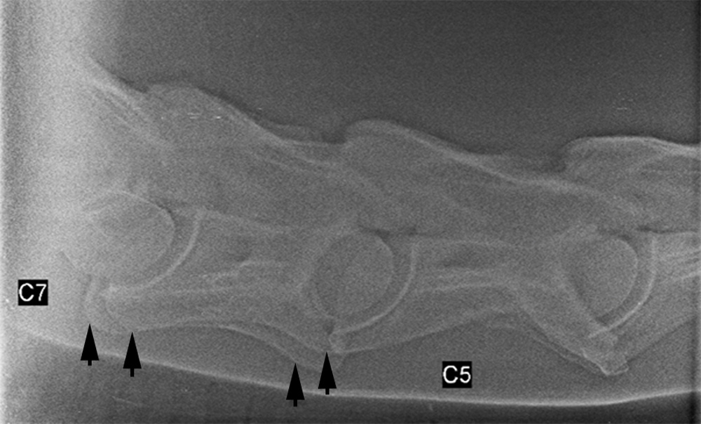 poor vetebral radiograph